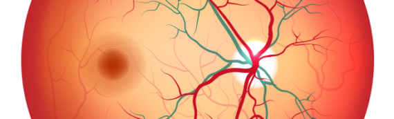 Por que a retina é tão susceptível a hemorragias